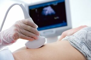 Doctor doing Ultrasound on women's stomach