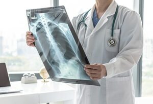Doctor holding up X-ray