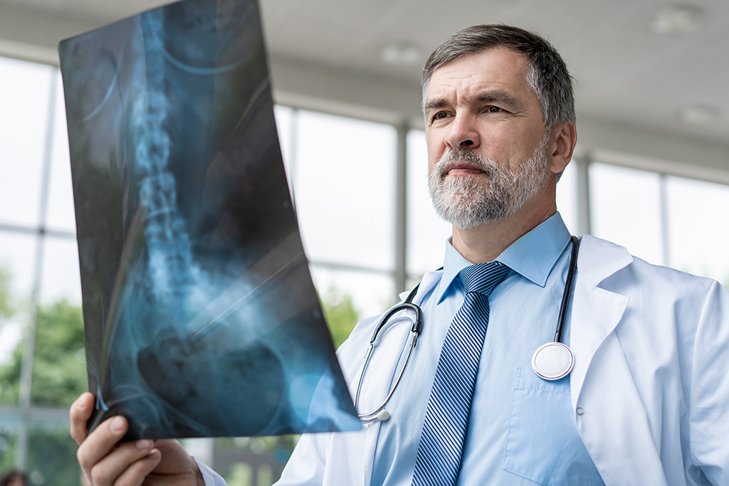 A male doctor with gray hair and a beard, wearing a white coat and stethoscope, examines an X-ray image of a spine while standing indoors.