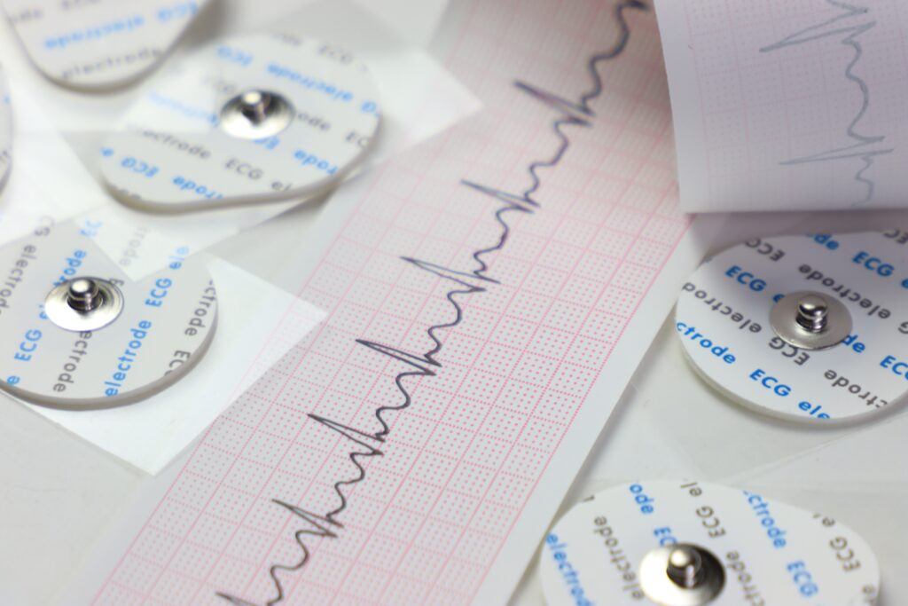 A close up of EKG trace paper in a white background with EKG electrodes.